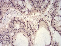 HIST2H3C(27Ac) Primary Antibody MP30900 [M2D7B3]