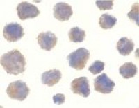 Anti-BACE1 / BACE Antibody (C-Terminus) MX-C377