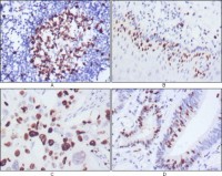 KI67 Primary Antibody MP20354 [M4A1]