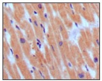 BNP Primary Antibody MP20158  [M3A6F7C7]