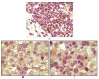 INHA (Inhibin alpha) Primary Antibody MP20106 [M4A2]