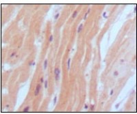 BNP Primary Antibody MP20157 [M9H6B4]