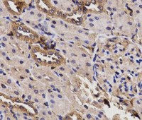 Anti-BCHE / Cholinesterase Antibody MX-C331478