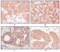 Cytokeratin(Pan) Primary Antibody MP20335 [M7H8]