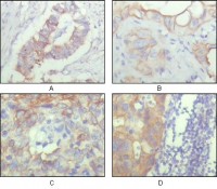 ALCAM Primary Antibody MP20232 [M10F1G12]