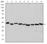 ACTA2 Primary Antibody MP30235 [M4A4]
