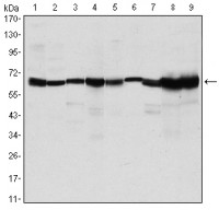 CARM1 Primary Antibody MP30153 [M3H2]