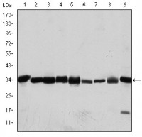 CDK1 Primary Antibody MP30181 [M2G9]