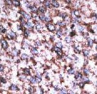 Anti-BACE2 Antibody (aa310-339) MX-C100355