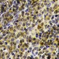 Anti-BTK Antibody (Internal) MX-C413087
