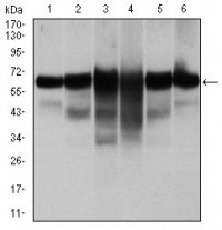 CK5 Primary Antibody MP30349 [M2C2]