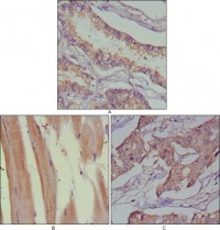 MUSK Primary Antibody MP20347 [M10A4]