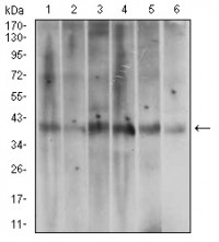 ACP5 Primary Antibody MP30539 [M7E6A11]