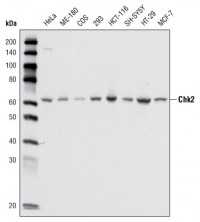 CHK2 Primary Antibody MP20223 [M1C12B8]