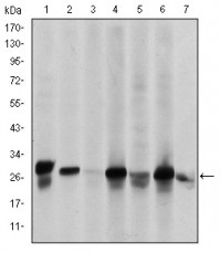 HSP27 Primary Antibody MP30213 [M5D7]