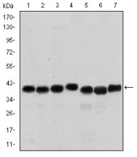SMN1 Primary Antibody MP30220 [M2F1]