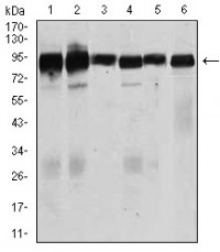 TGFBR3 Primary Antibody MP30449P [M1C5H11]