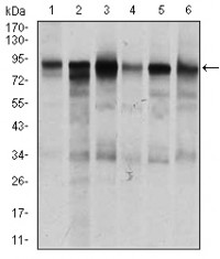 TGFBR3 Primary Antibody MP30449A [M1C5H11]