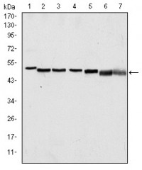 p63a Primary Antibody MP30176 [M4E5]