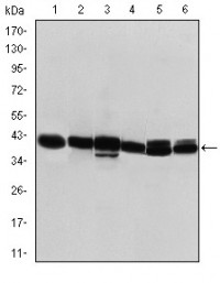 KRT19 Primary Antibody MP30226 [M1H6]