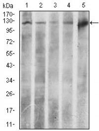 ACLY Primary Antibody MP30437 [M5F8D11]