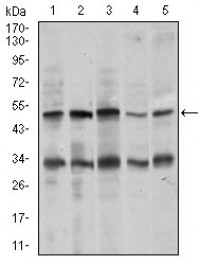 CHGA Primary Antibody MP30451P [M1A6B6]