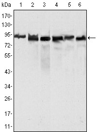 MLH1 Primary Antibody MP20246 [M4C9C7]