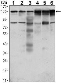 PTK7 Primary Antibody MP30078 [M4F9]