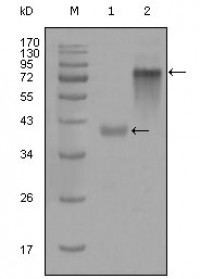 Cytokeratin 19 Primary Antibody MP20297 [M4F12G9]