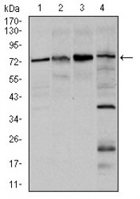 FOXO1 Primary Antibody MP30327 [M3B6]