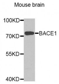 Anti-BACE1 / BACE Antibody (aa22-322) MX-C346301
