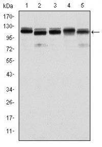 BMPR2 Primary Antibody MP30184 [M3F6]