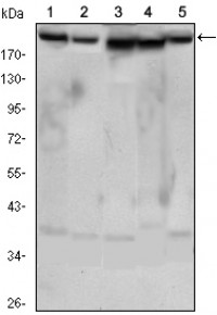 RICTOR Primary Antibody MP30090 [M7B3]
