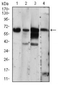 EIF2AK2 Primary Antibody MP30680 [M6H3A10]