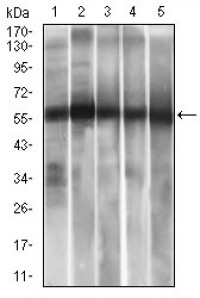 ALDH2 Primary Antibody  MP30471A [M4G6A3]