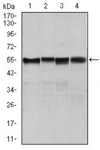 SLC2A4 Primary Antibody MP30445A [M3G10A3]