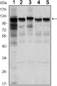 HK1 Primary Antibody MP30084 [M7A7]