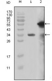 MLL Primary Antibody MP20179  [M10F8D7]