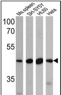 Anti-BACE2 Antibody MX-C355623