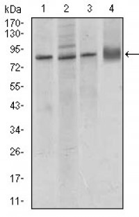 CDH5 Primary Antibody MP30447P [M3D5C7]