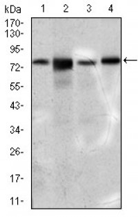 SLC27A5 Primary Antibody MP30455P  [M9C4D1]
