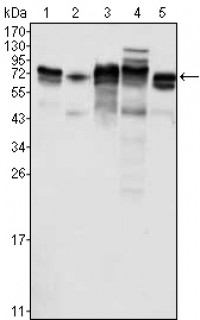 Metadherin Primary Antibody MP20407 [M2F11C3]