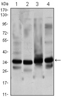 GTF2B Primary Antibody MP20420 [M4C1]
