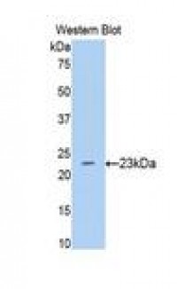 Anti-BACE1 / BACE Antibody (aa181-366) MX-C292996