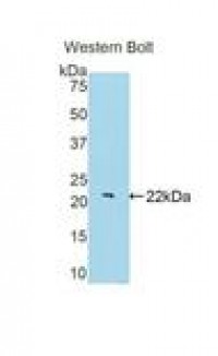 Anti-BACE2 Antibody (aa230-396, Biotin) MX-C300850