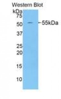 Anti-BACE2 Antibody (aa156-407) MX-C292995