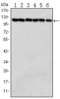 PARP Primary Antibody MP30016 [M7A10]