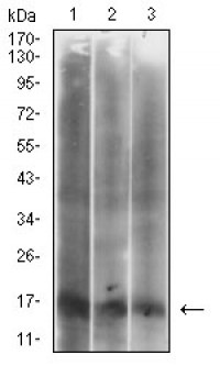 CDKN2A Primary Antibody MP30616 [M1D7D2A1]