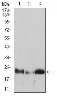HPRT1 Primary Antibody MP30677 [M5F11A7]
