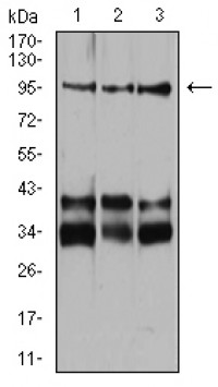 Neuropilin-1 Primary Antibody MP30824 [M5B1E11]